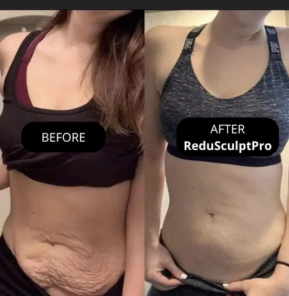 Amiuri ReduSculptPro™ Kit (FREE Retinol Serum Included)