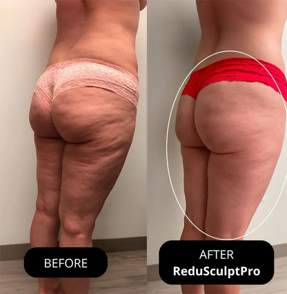 Amiuri ReduSculptPro™ Kit (FREE Retinol Serum Included)