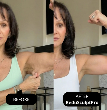 Amiuri ReduSculptPro™ Kit (FREE Retinol Serum Included)