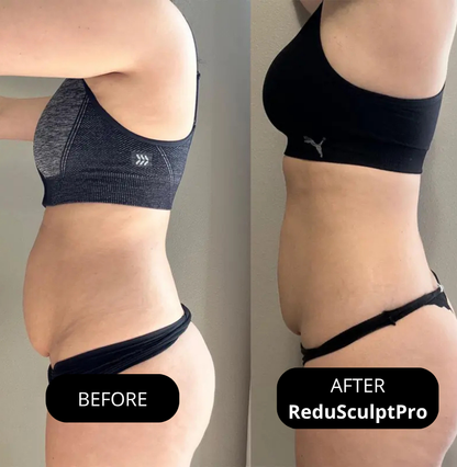 Amiuri ReduSculptPro™ Kit (FREE Retinol Serum Included)