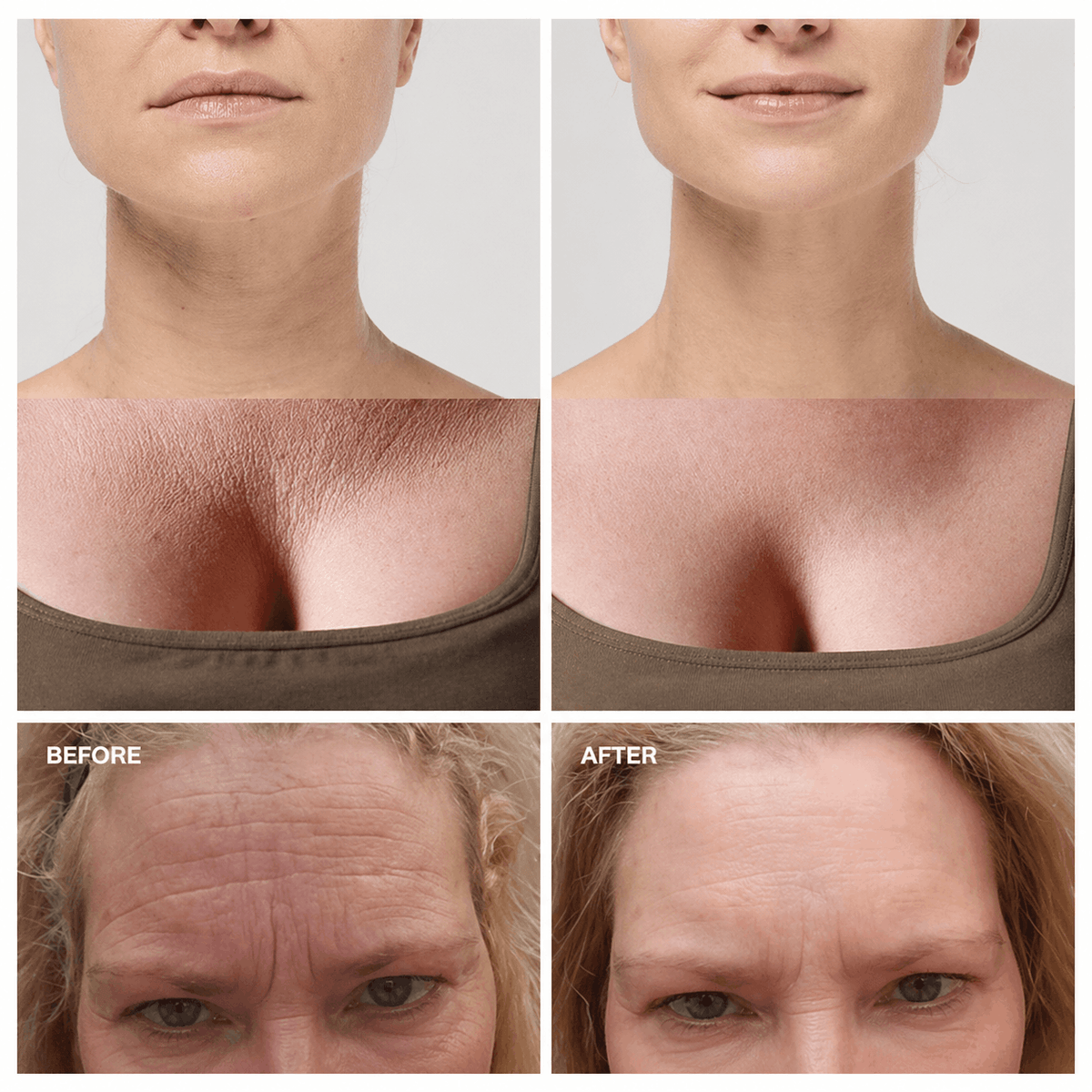 Amiuri™ Anti-Falten-Pflaster | (All-in-One)