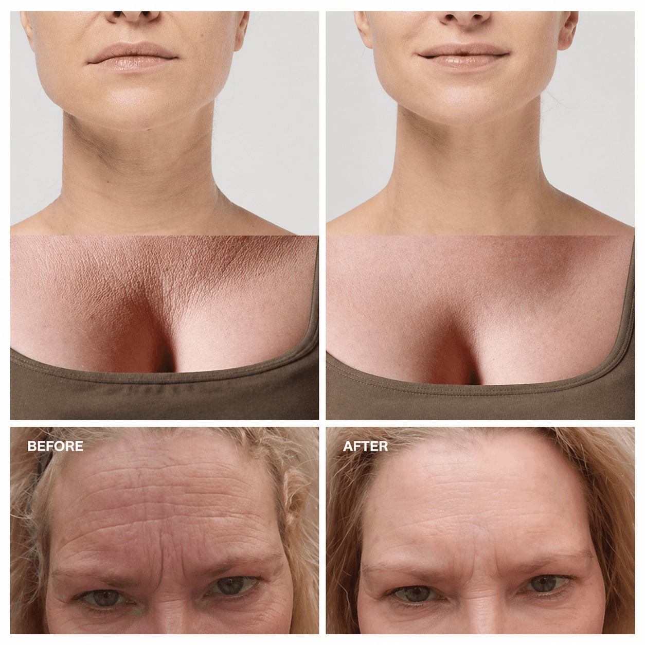 Amiuri™ Anti-Falten-Pflaster | (All-in-One)