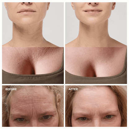 Amiuri™ Anti-Falten-Pflaster | (All-in-One)