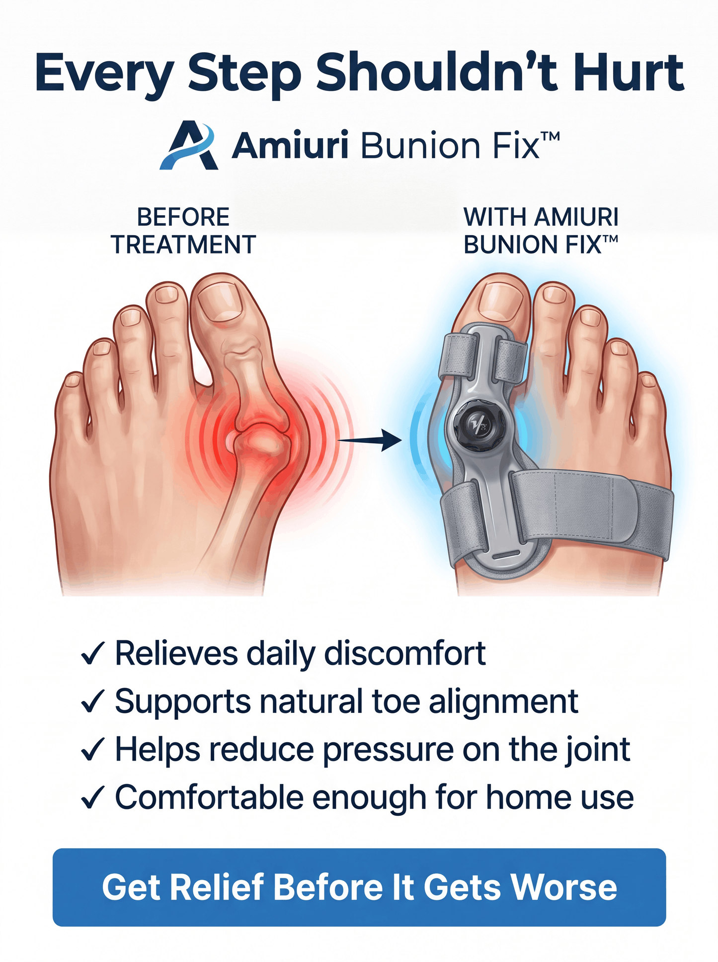 Amiuri BunionFix™